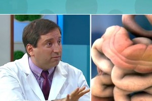 Dr. Felipe Bellolio explica mitos y verdades del cáncer de colón
