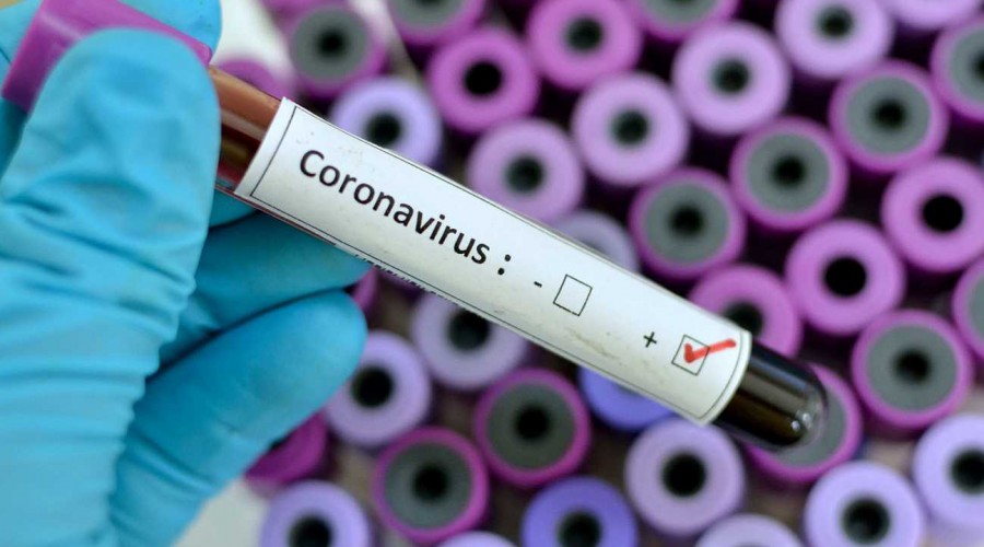 #5Tips: ¿Cómo protegerse del coronavirus si viajas fuera de Chile?