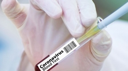 Científico chileno que trabaja en vacuna contra Covid-19: "Necesitan última prueba que se denomina eficacia"