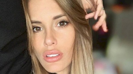 Tratamiento preventivo de vejez: Gala Caldirola contó como eliminará sus "arrugas"