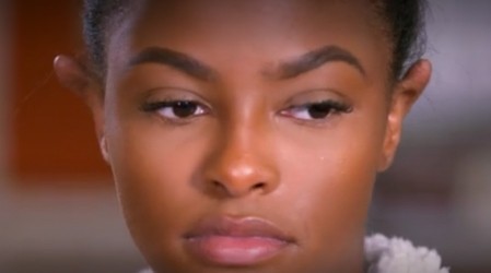 La Dra Sandra Lee quitó dos queloides de las orejas