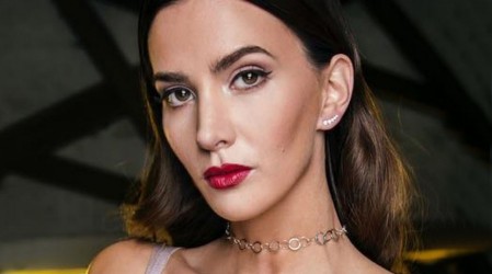 ¿Nuevo look? Aylén Milla luce un rostro diferente tras procedimiento estético