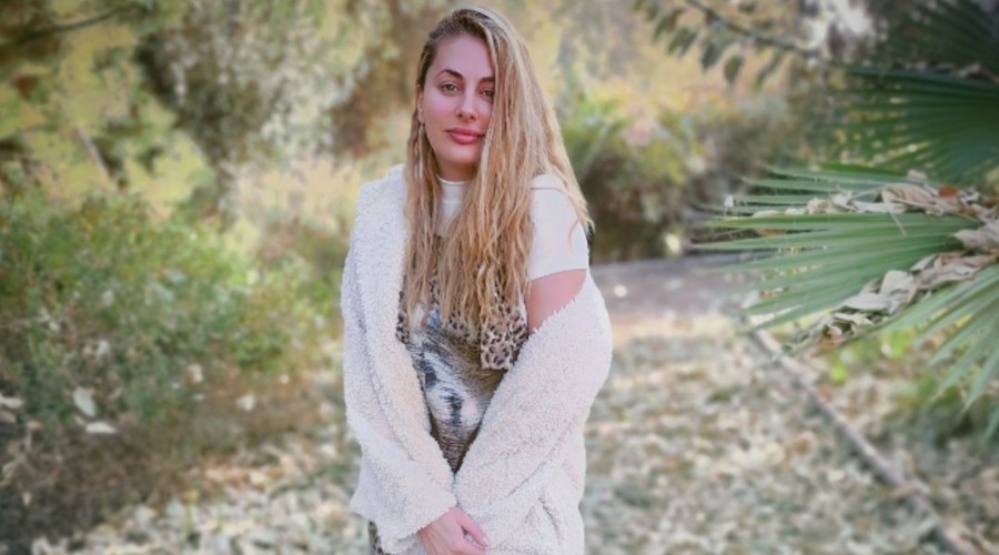 'Te ves mal': Usuario en Instagram critica a Catalina Palacios por los retoques en su rostro
