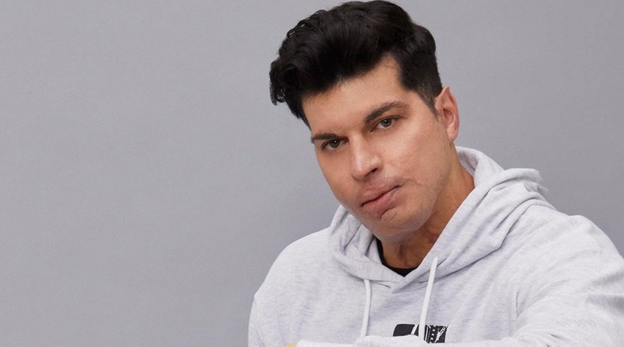 Ignacio Lastra sorprende con el marcado 'six pack' que luce actualmente