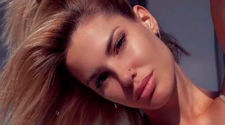 'La nueva Oriana': Seguidores aseguran que Gala Caldirola se realizó procedimiento en sus labios