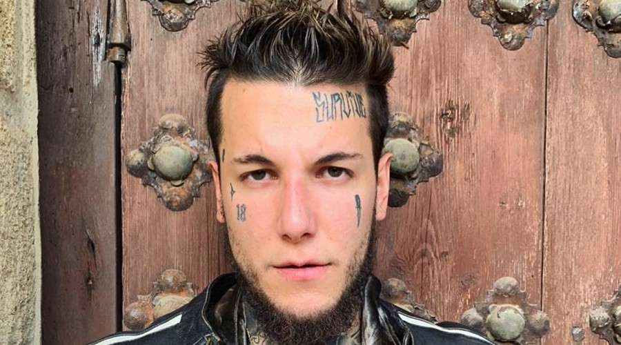 'Cada dia estoy mas facha': Alex Caniggia se operó la mandíbula y sorprende con los resultados 'Cada dia estoy mas facha': Alex Caniggia se operó la mandíbula y sorprende con los resultados