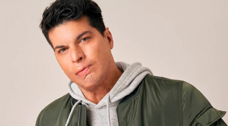 'Te pasaste': Seguidores de Ignacio Lastra celebran su increíble progreso y tonificado cuerpo 'Te pasaste': Seguidores de Ignacio Lastra celebran su increíble progreso y tonificado cuerpo