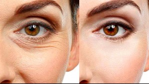 'JuveNatur': Descubre la fórmula que busca reducir los signos del envejecimiento de la piel