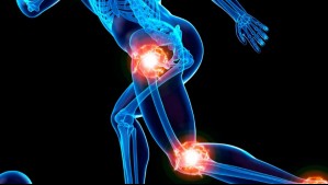 ¿Sufres de dolor articular? Conoce las soluciones que ofrece el mercado para mitigar los efectos