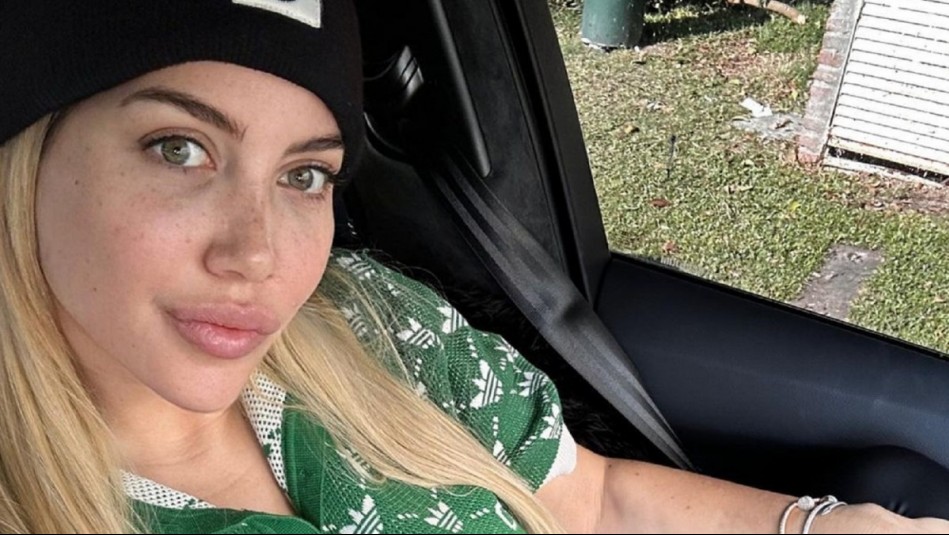 'Dejaba los dolores de lado': Cuáles son los síntomas que presentó Wanda Nara por su enfermedad