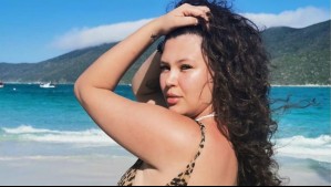 'Se vienen unos largos 6 meses': Michelle Carvalho revela que padece de alopecia