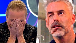 ¡5 años después lo descubren!: Guionista y actor conocen origen de la cicatriz de Leonardo en Verdades Ocultas