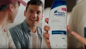 'Ni un pelo de tonto': Marco y Joselo toman acción sobre la caspa y la caída del pelo