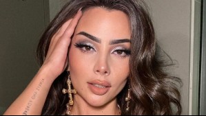 VaiMonroe renueva sus labios en Melbourne con nueva técnica para lucir "más natural": Así se ve sin rellenos