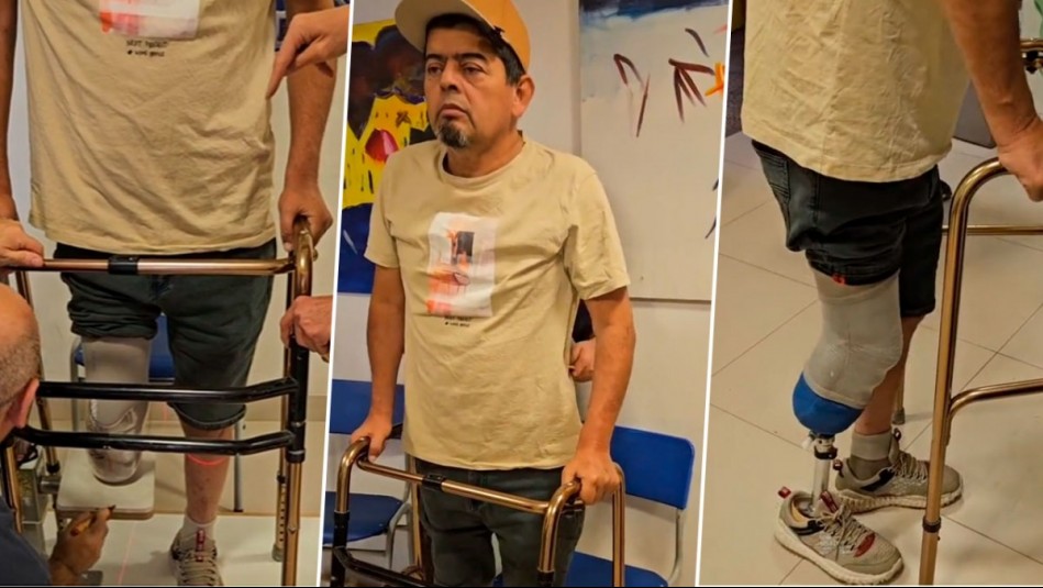 'Muchas gracias a todos': Mauricio Medina mostró su proceso de rehabilitación con pierna ortopédica