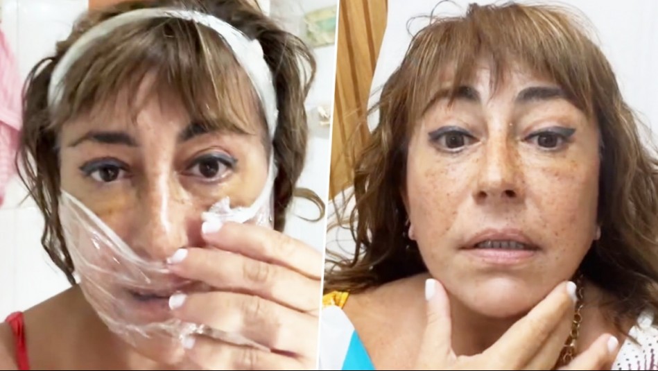 'Estoy tan feliz': Helhue Sukni muestra el estado actual de su rostro tras complicada cirugía