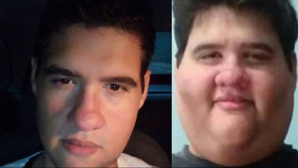 Muere popular influencer brasileño conocido por su lucha contra la obesidad: Había logrado bajar 200 kilos