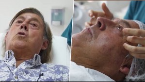 Emeterio Ureta realiza tratamiento para sus ojeras antes de la Gala de Viña: 'Ha sido mi complejo'