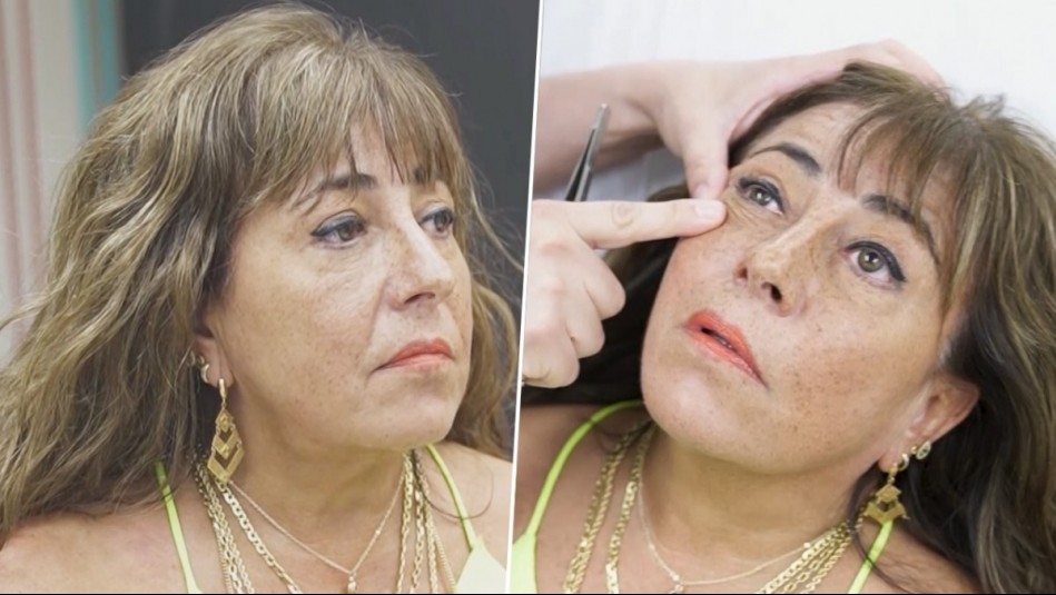 Helhue Sukni sorprende a médico tras advertencia sobre su operación: 'Yo soy un quiltro de la calle'