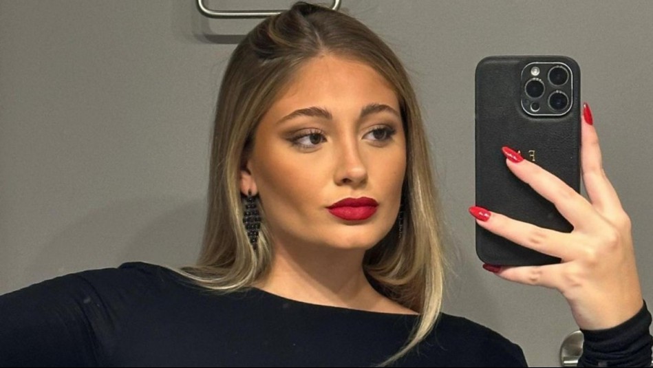 'Mejoró mucho mi piel': Florencia Araneda se somete a innovador tratamiento facial