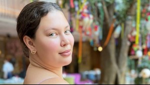 "Suelen hacer esta pregunta": Michelle Carvalho responde a consultas sobre supuesta intervención estética