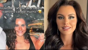 'No inventen': La categórica respuesta de Emilia Dides ante rumores sobre operación en su rostro