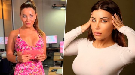 Chica reality muestra impactantes fotos de su cirugía de armonización facial