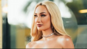 Fran Maira sigue el mismo tratamiento estético de las Kardashian: "Les estamos copiando"