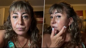 "Estoy mejor...": Helhue Sukni actualizó el estado de la operación donde le "sacaron la cara"