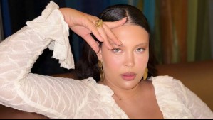 "Este año me voy a empezar a cuidar más": Este es el tratamiento estético que inició Michelle Carvalho