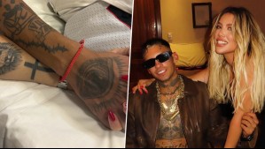 "Gracias por el amor y el cuidado": Wanda Nara muestra cómo quedó L-Gante tras sufrir accidente