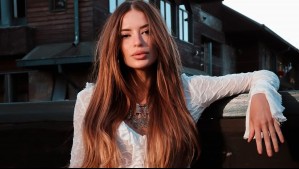 "Envejecí 20 años": Julia Fernandes mostró impactantes imágenes tras quemarse la cara