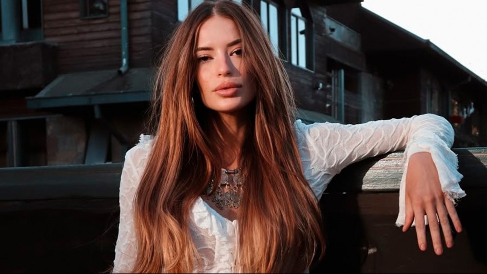 'Envejecí 20 años': Julia Fernandes mostró impactantes imágenes tras quemarse la cara