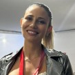 Un tratamiento innovador se aplicó Gissella Gallardo para rejuvenecer su rostro, que consiste en la aplicación de ADN de salmón para mejorar su aspecto.