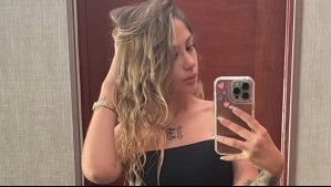 Trini Neira muestra el impactante proceso de borrarse un tatuaje en el cuello