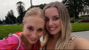 Hija de Karen Doggenweiler recuerda compleja operación en su columna: Mostró el antes y el después