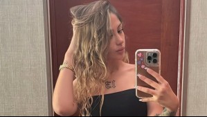 Trini Neira muestra impactante imagen de cómo va el borrado de tatuaje en su mano