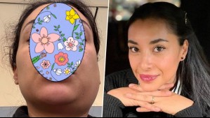 El complejo estado de salud de Natalia 'Arenita' Rodríguez: Fue hospitalizada por problema en su rostro