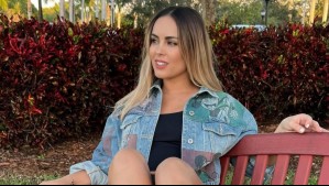 Maura Rivera reaparece en Chile: Este es el tratamiento estético que se hizo