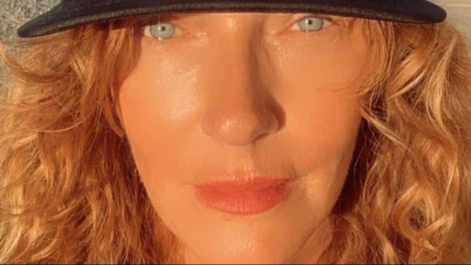 'Estás estupenda': El antes y después de Catalina Pulido tras tratamiento estético