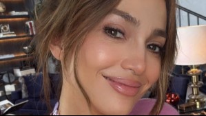 Así fue la lesión que sufrió Jennifer Lopez en su nariz durante ensayos para los American Music Awards