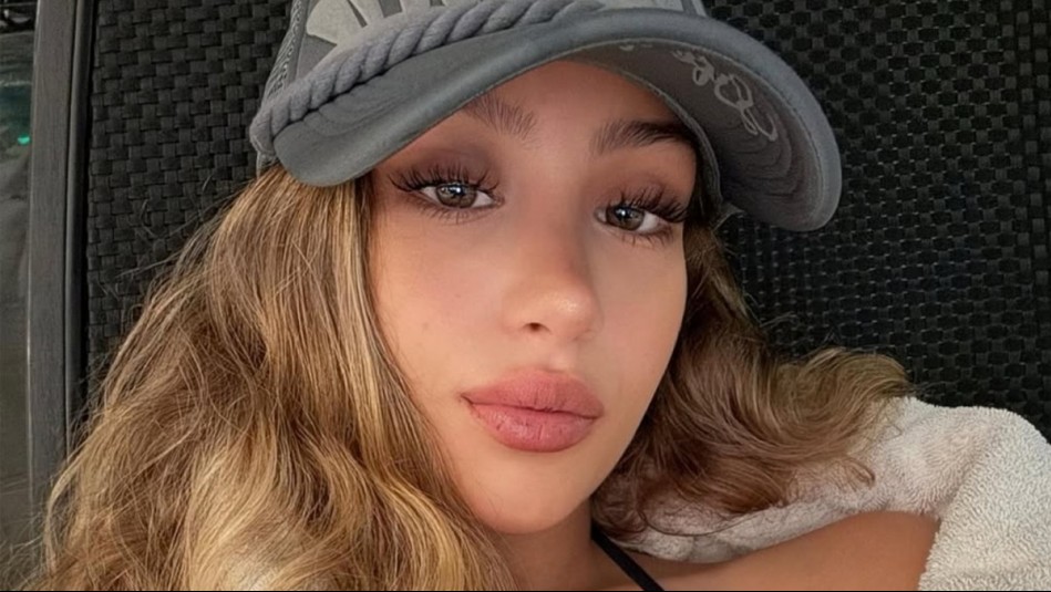 'Así va...': Trini Neira muestra cómo avanza el proceso de borrado de sus tatuajes