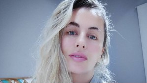 "El secreto para una piel más joven": Catalina Palacios reveló el tratamiento que deja su rostro radiante