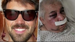 'Me dijo 'me golpearon por un cigarro'': Hijo de conserje golpeado en Vitacura relata lo vivido por su padre