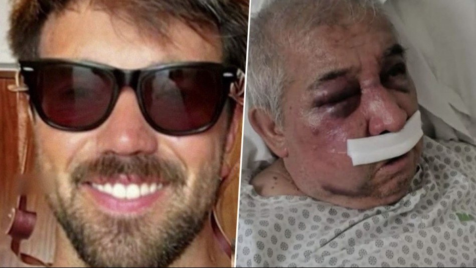 'Me dijo 'me golpearon por un cigarro'': Hijo de conserje golpeado en Vitacura relata lo vivido por su padre