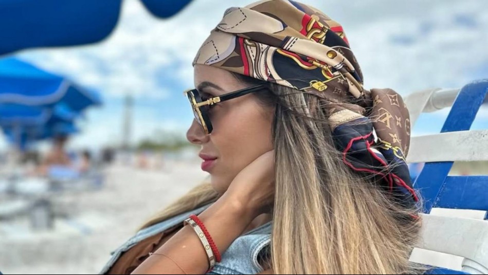 El antes y después del cabello de Marité Matus: Cambia su color a un avellana blonde que ilumina