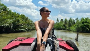 El accidente de Kel Calderón durante sus vacaciones en Vietnam: Así quedó su pierna