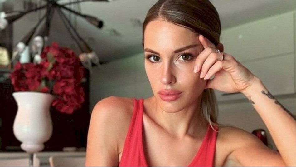 'Mi cuerpo expulsó solo...': Gala Caldirola muestra las impactantes secuelas de su accidente en reality show