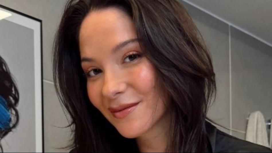 Kel Calderón revela el 'milagro' que experimenta en su pierna: Así se recupera de una quemadura