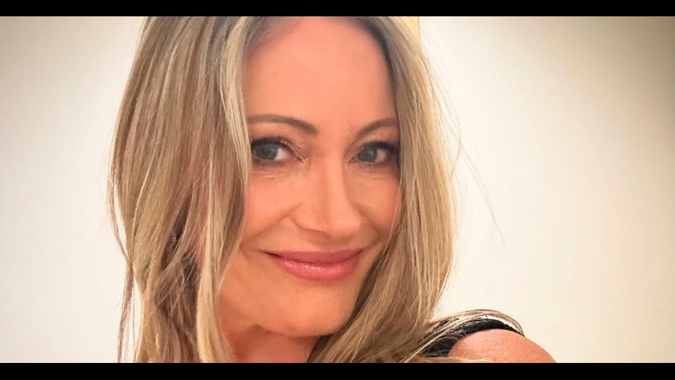 'El mejor de estos tiempos': Marcela Vacarezza revela el innovador tratamiento estético que se realizó en EEUU